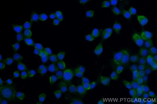 CAMSAP1 Antibody in Immunocytochemistry (ICC/IF)