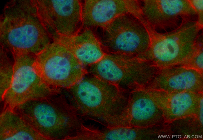 Loricrin Antibody in Immunocytochemistry (ICC/IF)