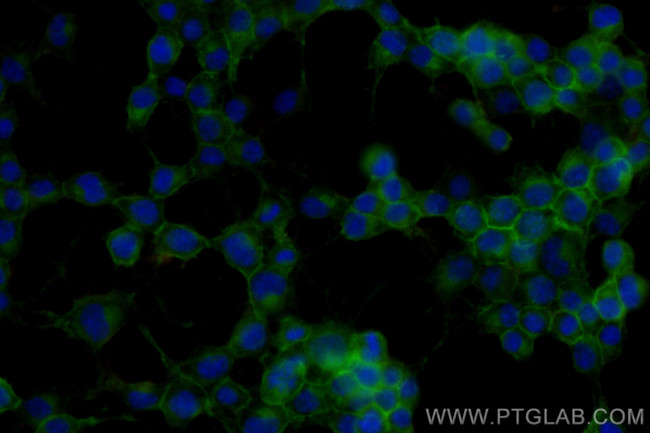 NCAM1/CD56 Antibody in Immunocytochemistry (ICC/IF)