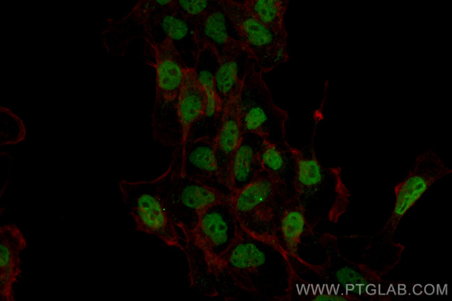 ETV4 Antibody in Immunocytochemistry (ICC/IF)