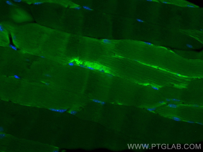 FBP2 Antibody in Immunohistochemistry (Paraffin) (IHC (P))