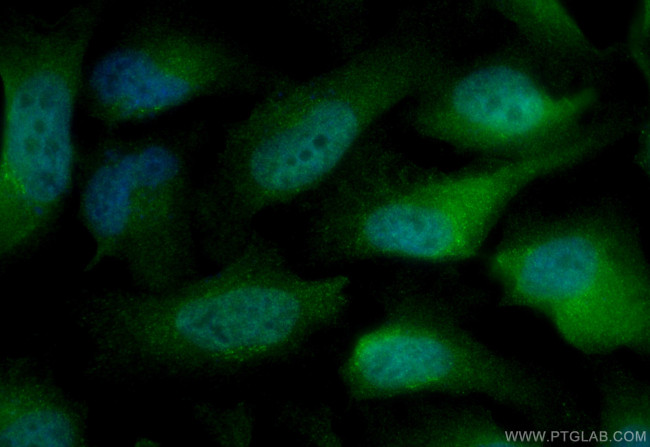 BUB1B Antibody in Immunocytochemistry (ICC/IF)
