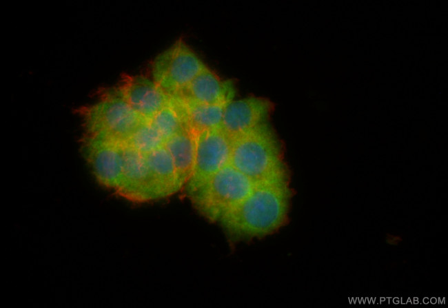 NEU2 Antibody in Immunocytochemistry (ICC/IF)