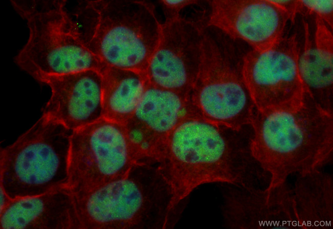 CCAR1 Antibody in Immunocytochemistry (ICC/IF)