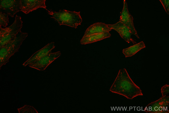TLE3 Antibody in Immunocytochemistry (ICC/IF)