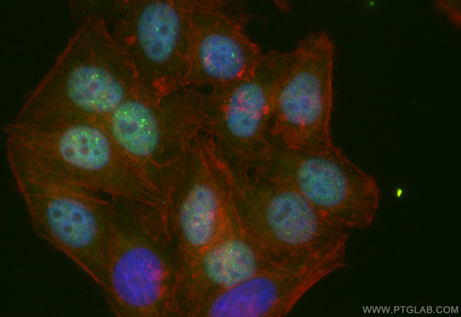RNGTT Antibody in Immunocytochemistry (ICC/IF)