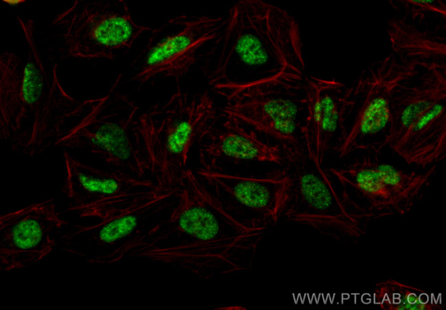 AGXT2L1 Antibody in Immunocytochemistry (ICC/IF)