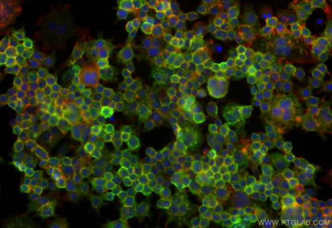 GDF5 Antibody in Immunocytochemistry (ICC/IF)