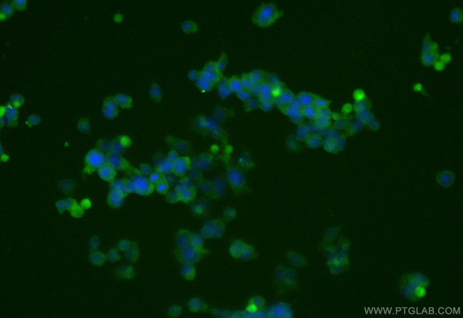 KIF5A Antibody in Immunocytochemistry (ICC/IF)