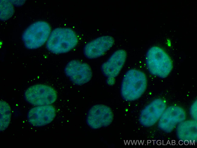 SUMO2/3 Antibody in Immunocytochemistry (ICC/IF)