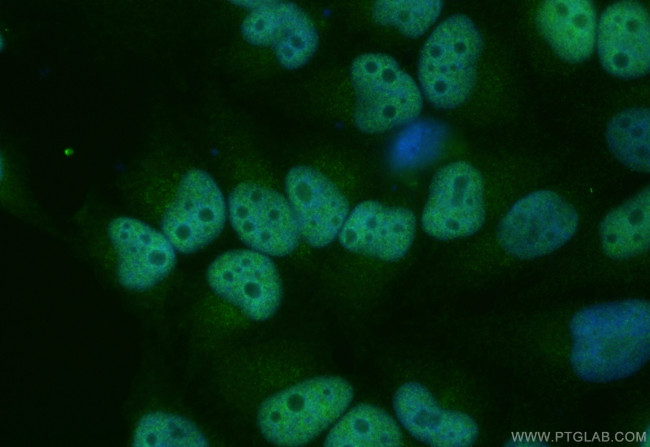 FOXF1 Antibody in Immunocytochemistry (ICC/IF)