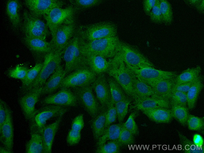 NFKB2,p100 Antibody in Immunocytochemistry (ICC/IF)