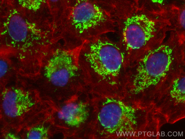 ACSF2 Antibody in Immunocytochemistry (ICC/IF)