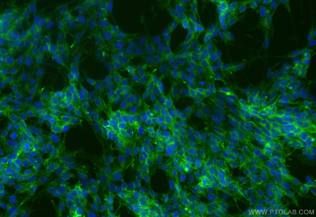 L1CAM Antibody in Immunocytochemistry (ICC/IF)