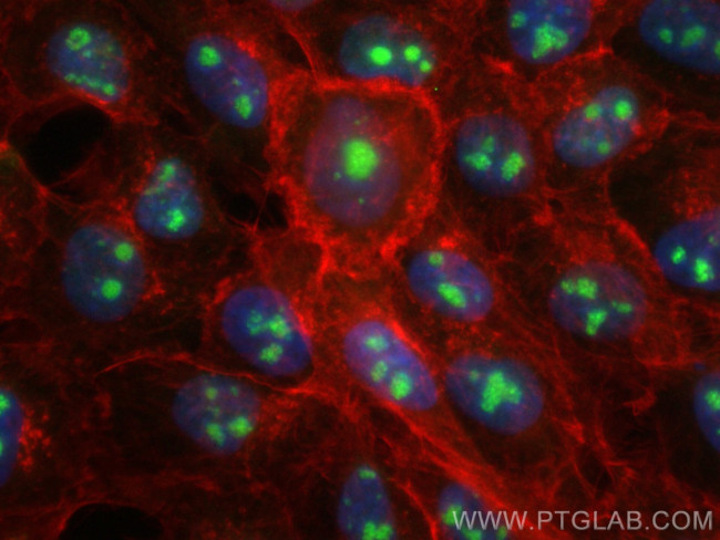 UTP18 Antibody in Immunocytochemistry (ICC/IF)
