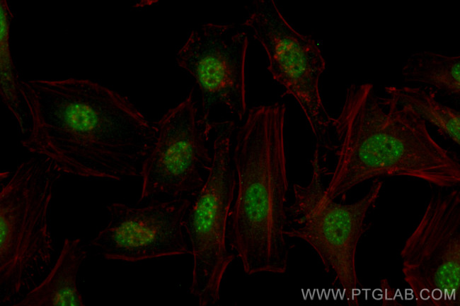 RREB1 Antibody in Immunocytochemistry (ICC/IF)