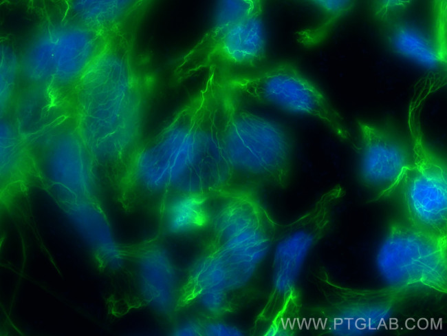 CTNNAL1 Antibody in Immunocytochemistry (ICC/IF)