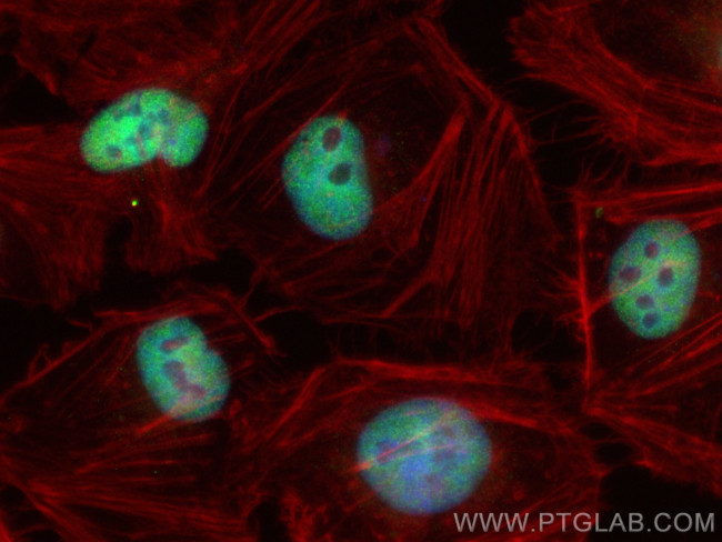 RNF40 Antibody in Immunocytochemistry (ICC/IF)