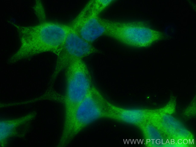 KLK3/PSA Antibody in Immunocytochemistry (ICC/IF)