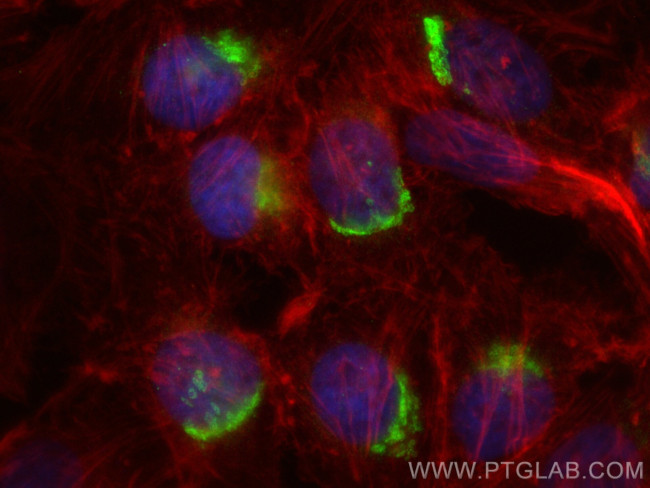 Clusterin Antibody in Immunocytochemistry (ICC/IF)
