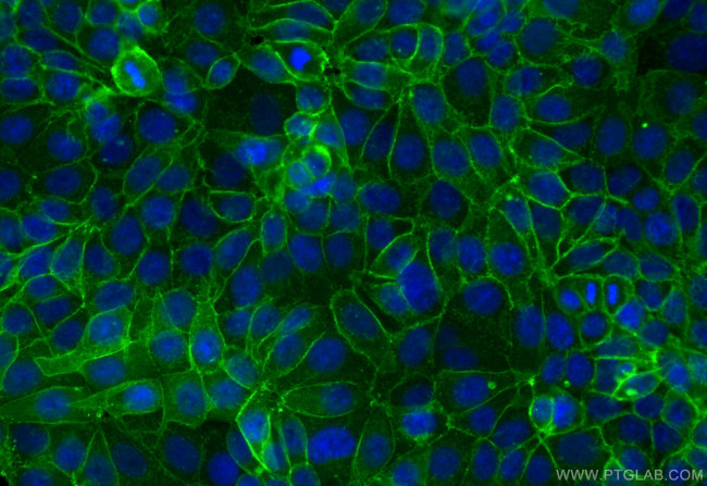EPCAM/CD326 Antibody in Immunocytochemistry (ICC/IF)