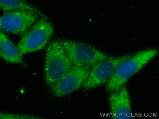 Complement factor B Antibody in Immunocytochemistry (ICC/IF)