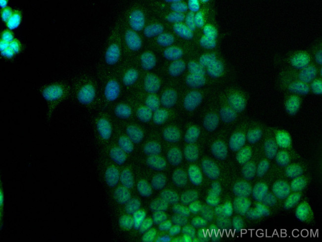 TSEN34 Antibody in Immunocytochemistry (ICC/IF)