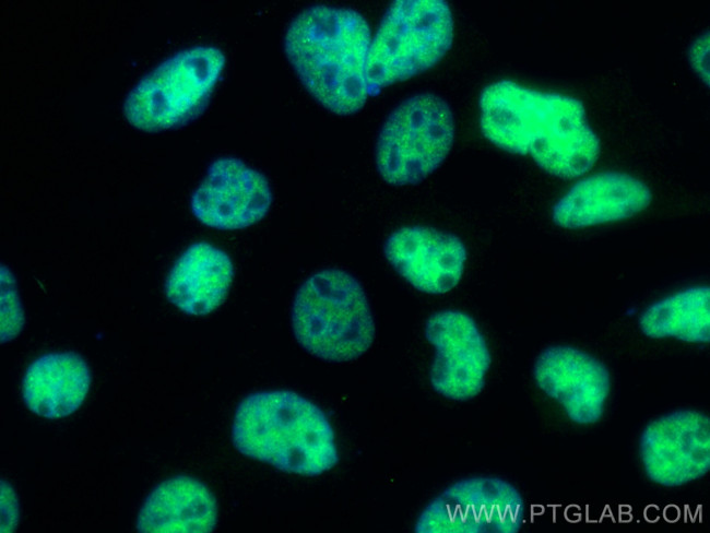 RBM10 Antibody in Immunocytochemistry (ICC/IF)