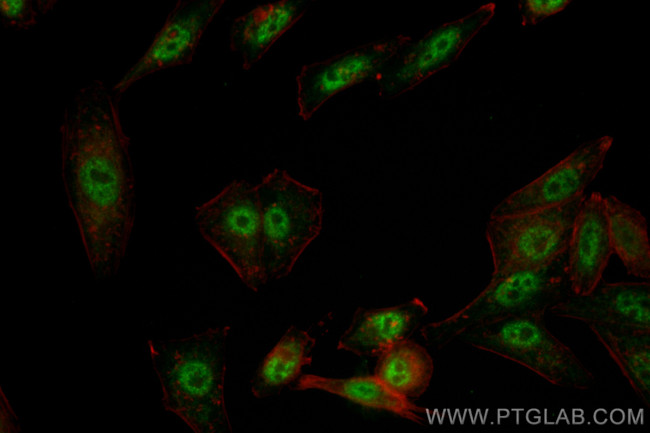 GLI2 Antibody in Immunocytochemistry (ICC/IF)
