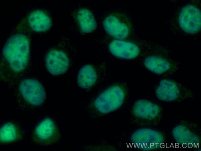 IMUP Antibody in Immunocytochemistry (ICC/IF)