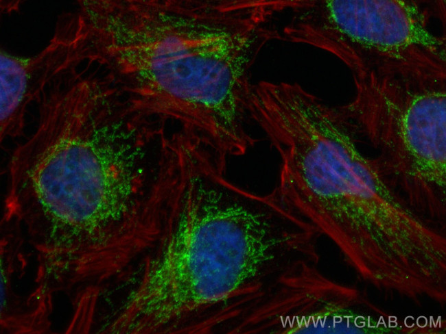 FAM136A Antibody in Immunocytochemistry (ICC/IF)
