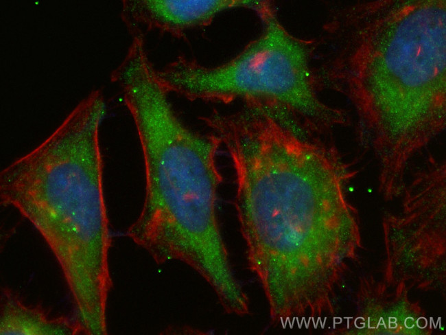 AP2S1 Antibody in Immunocytochemistry (ICC/IF)
