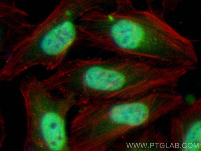 METTL6 Antibody in Immunocytochemistry (ICC/IF)