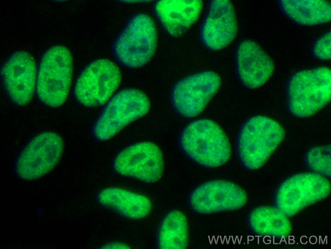 ASUN Antibody in Immunocytochemistry (ICC/IF)
