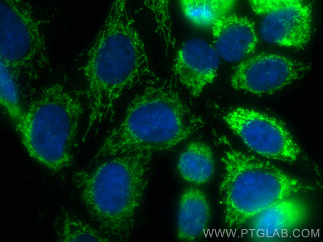 NSUN4 Antibody in Immunocytochemistry (ICC/IF)