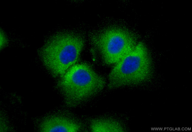 POTEA Antibody in Immunocytochemistry (ICC/IF)