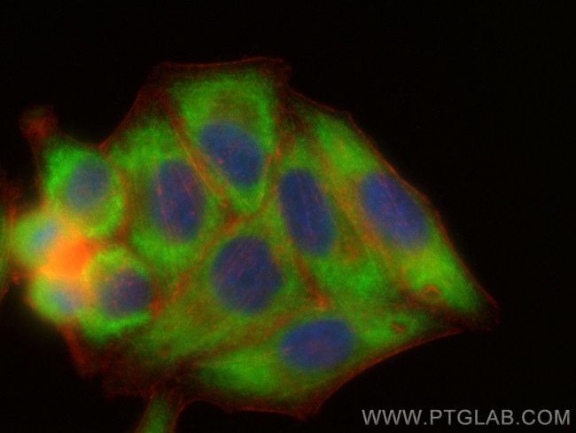 MTMR4 Antibody in Immunocytochemistry (ICC/IF)