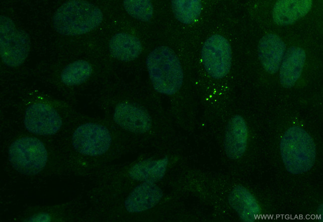 TFDP2 Antibody in Immunocytochemistry (ICC/IF)