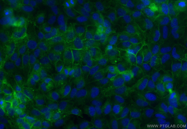 Integrin alpha-5 Antibody in Immunocytochemistry (ICC/IF)