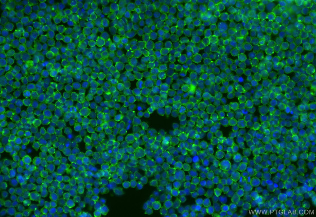 SELPLG/CD162 Antibody in Immunocytochemistry (ICC/IF)