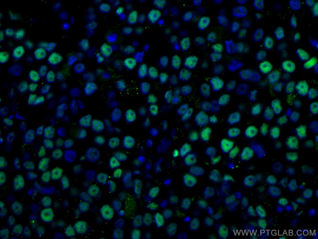 PCNA Antibody in Immunohistochemistry (Paraffin) (IHC (P))