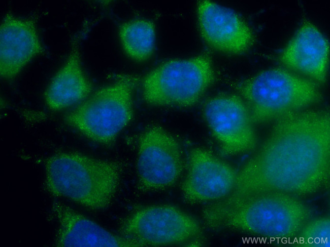 S100A6 Antibody in Immunocytochemistry (ICC/IF)