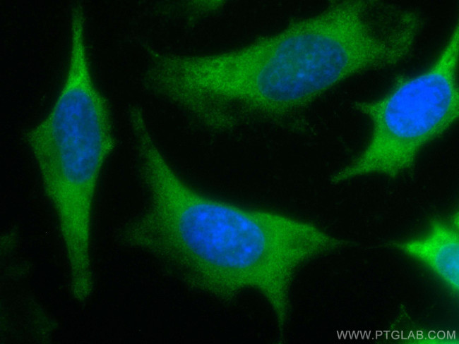 IkB Alpha Antibody in Immunocytochemistry (ICC/IF)