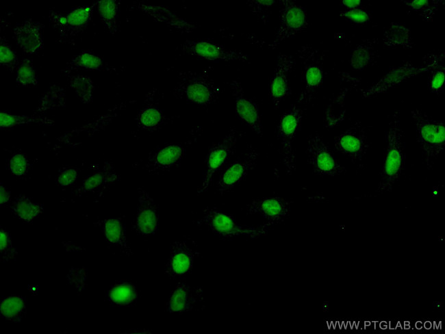 PAX8 Antibody in Immunocytochemistry (ICC/IF)