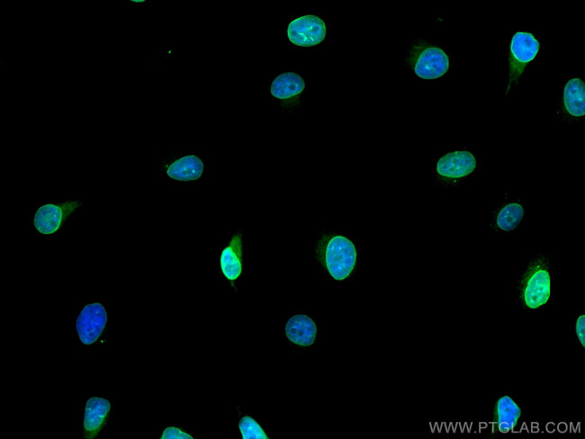 Emerin Antibody in Immunocytochemistry (ICC/IF)