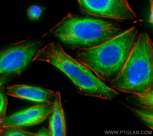 Vimentin Antibody in Immunocytochemistry (ICC/IF)