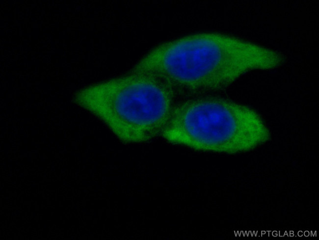 MMP9 Antibody in Immunocytochemistry (ICC/IF)