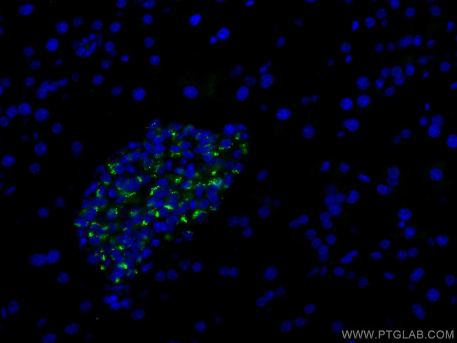 Chromogranin A Antibody in Immunohistochemistry (Paraffin) (IHC (P))