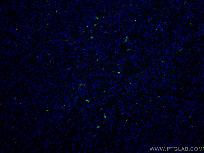 HO-1/HMOX1 Antibody in Immunohistochemistry (Paraffin) (IHC (P))