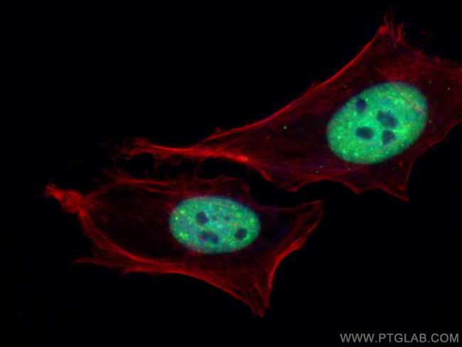 TDP-43 Antibody in Immunocytochemistry (ICC/IF)